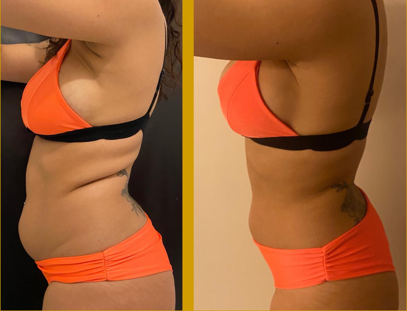Resultado Tríade 360° — Transformação corporal lateral